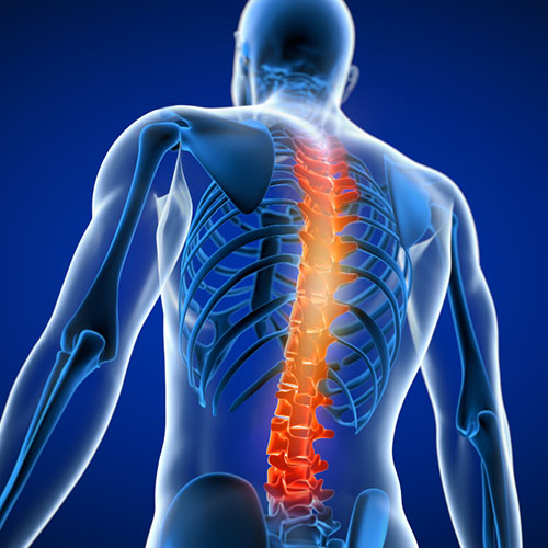 Back Pain Treatment