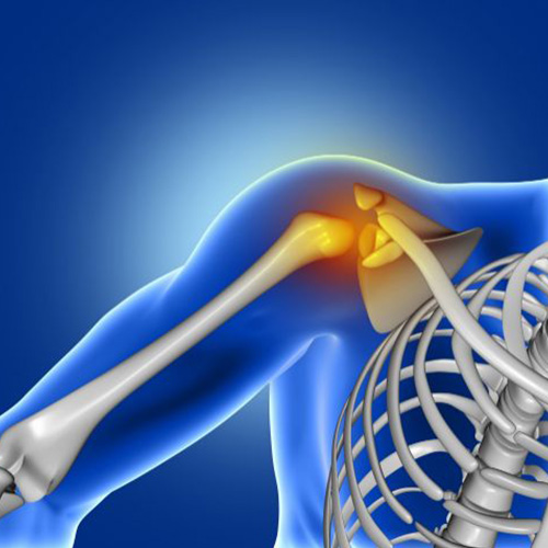 Frozen shoulder treatment with ultrasound-guided hydrodilatation in Delhi
